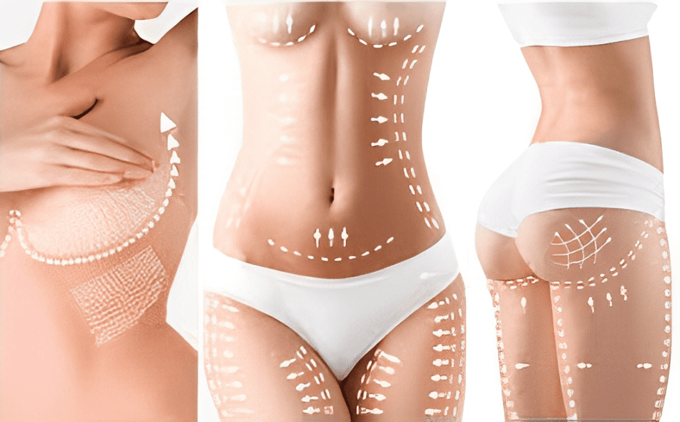 A collage of three different women 's body contouring images.