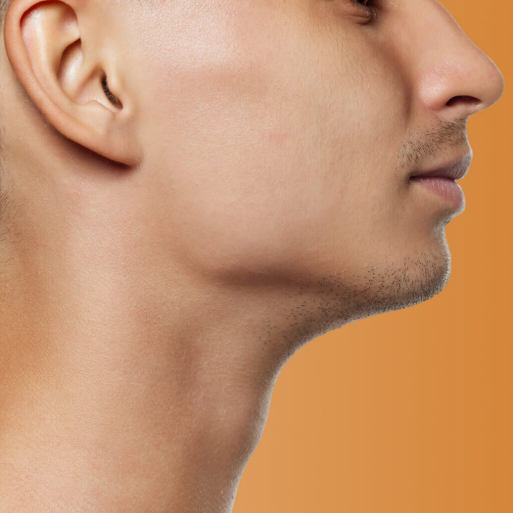 Chin & Jawline