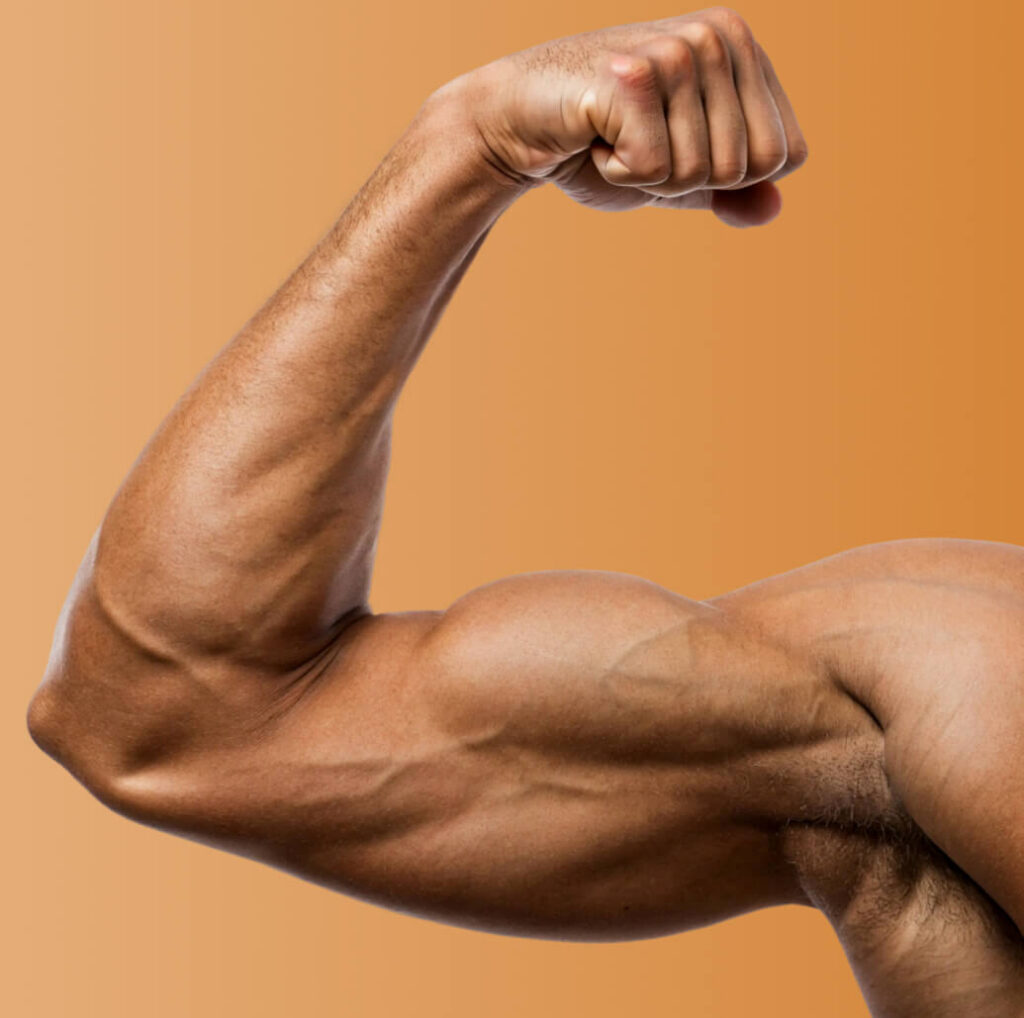 Arms
