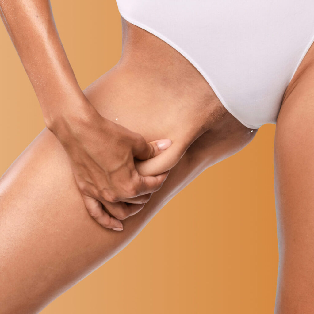 Inner Thighs