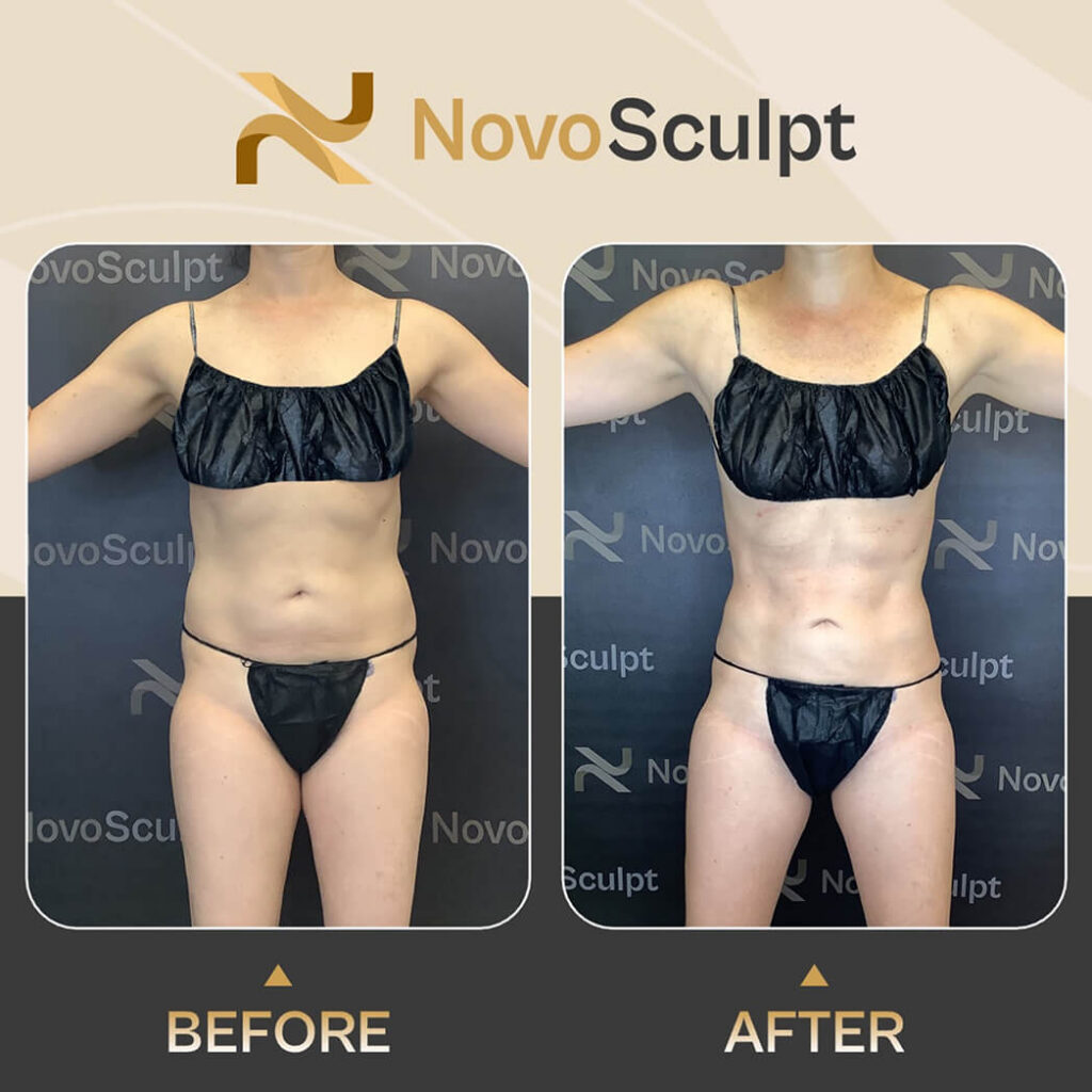 Before and After front