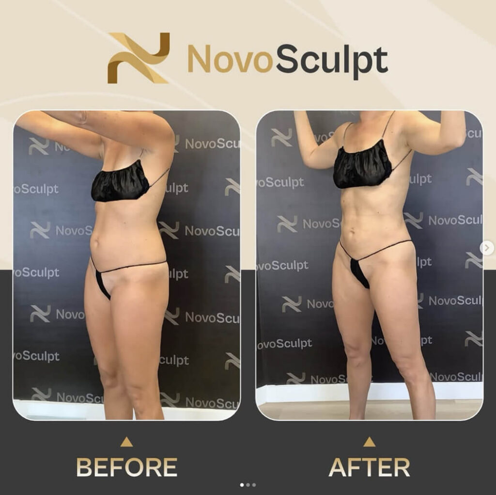 Before and After super thin